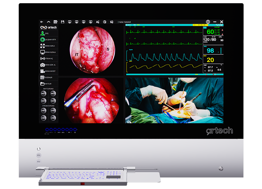 Ameliyathane Entegrasyon Sistemi - Dijital Negatoskop & Teletıp Sistemi
