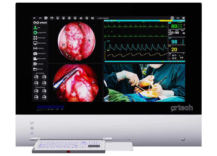 OR Integration System - Digital Negatoscope & Telemedicine System