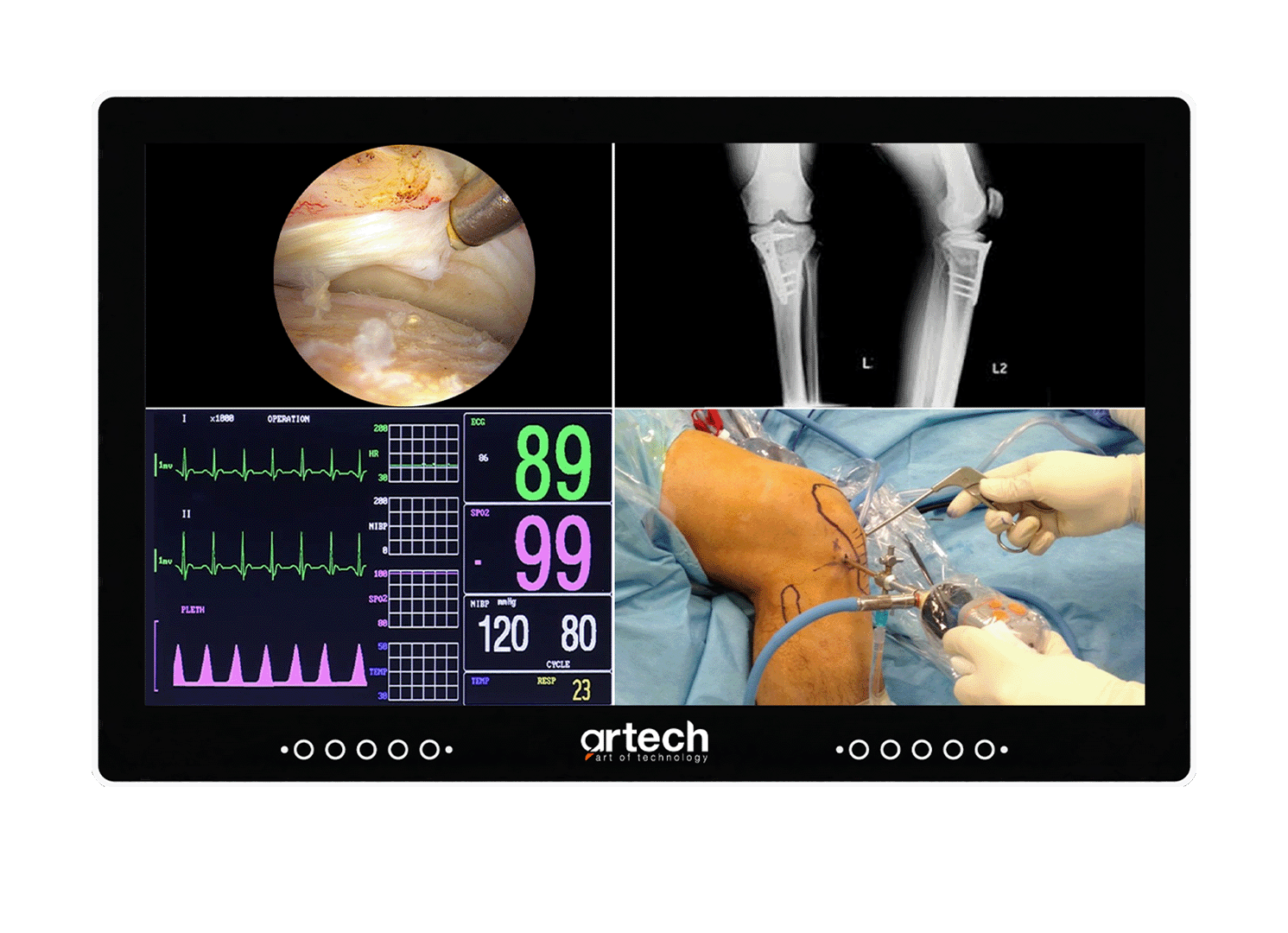 OR Integration System - Surgical Monitor